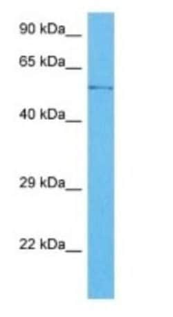 ZCCHC7 Rabbit anti-Human, Polyclonal, Novus Biologicals:Antibodies:Primary